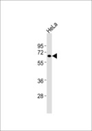Complement C1R Antibody - Anti-HIC2 Antibody at 1:1000 dilution + HeLa whole cell lysates Lysates/proteins at 20 ug per lane. Secondary Goat Anti-Rabbit IgG, (H+L),Peroxidase conjugated at 1/10000 dilution Predicted band size : 66 kDa Blocking/Dilution buffer: 5% NFDM/TBST.