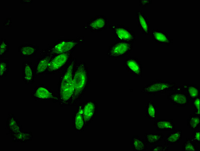 Complement C1R Antibody - Immunofluorescent analysis of Hela cells at a dilution of 1:100 and Alexa Fluor 488-congugated AffiniPure Goat Anti-Rabbit IgG(H+L)