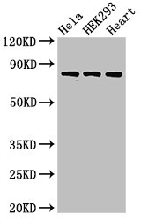 Complement C1R Antibody - Positive Western Blot detected in Hela whole cell lysate, HEK293 whole cell lysate, Rat heart tissue. All lanes: C1R antibody at 3 µg/ml Secondary Goat polyclonal to rabbit IgG at 1/50000 dilution. Predicted band size: 81 KDa. Observed band size: 81 KDa