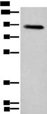 Complement C1R Antibody - Western blot analysis of Human plasma solution  using C1R Polyclonal Antibody at dilution of 1:800