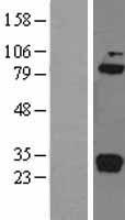 Complement C1R Protein - Western validation with an anti-DDK antibody * L: Control HEK293 lysate R: Over-expression lysate