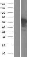 Complement C1RL Protein - Western validation with an anti-DDK antibody * L: Control HEK293 lysate R: Over-expression lysate
