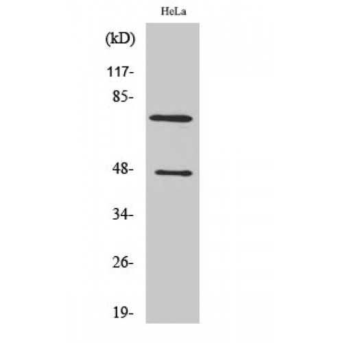 Complement C1s Antibody - Western blot of Cleaved-C1s HC (R437) antibody