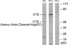 Complement C1s Antibody - Western blot of extracts from 293/HeLa cells, treated with etoposide 25 uM 1h, using C1S (heavy chain, Cleaved-Arg437) Antibody. The lane on the right is treated with the synthesized peptide.