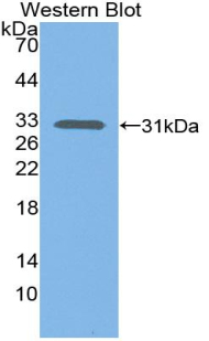 Complement C1s Antibody - Western blot of recombinant Complement C1s.