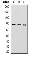 Complement C1s Antibody - Western blot analysis of Complement C1S expression in A549 (A); HeLa (B); Jurkat (C) whole cell lysates.