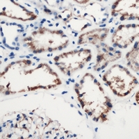 Complement C1s Antibody - Immunohistochemical analysis of Complement C1S staining in human kidney formalin fixed paraffin embedded tissue section. The section was pre-treated using heat mediated antigen retrieval with sodium citrate buffer (pH 6.0). The section was then incubated with the antibody at room temperature and detected with HRP and DAB as chromogen. The section was then counterstained with hematoxylin and mounted with DPX.