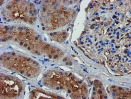 Complement C1s Antibody - IHC of paraffin-embedded Human Kidney tissue using anti-C1S mouse monoclonal antibody. (Heat-induced epitope retrieval by 10mM citric buffer, pH6.0, 100C for 10min).
