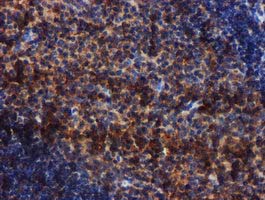 Complement C1s Antibody - IHC of paraffin-embedded Human tonsil using anti-C1S mouse monoclonal antibody. (Heat-induced epitope retrieval by 10mM citric buffer, pH6.0, 100C for 10min).