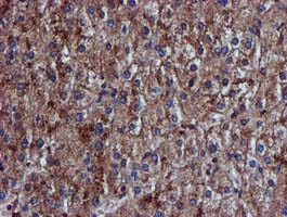 Complement C1s Antibody - IHC of paraffin-embedded Human liver tissue using anti-C1S mouse monoclonal antibody.