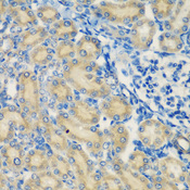 Complement C1s Antibody - Immunohistochemistry of paraffin-embedded rat kidney tissue.