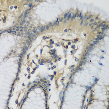 Complement C1s Antibody - Immunohistochemistry of paraffin-embedded human stomach tissue.