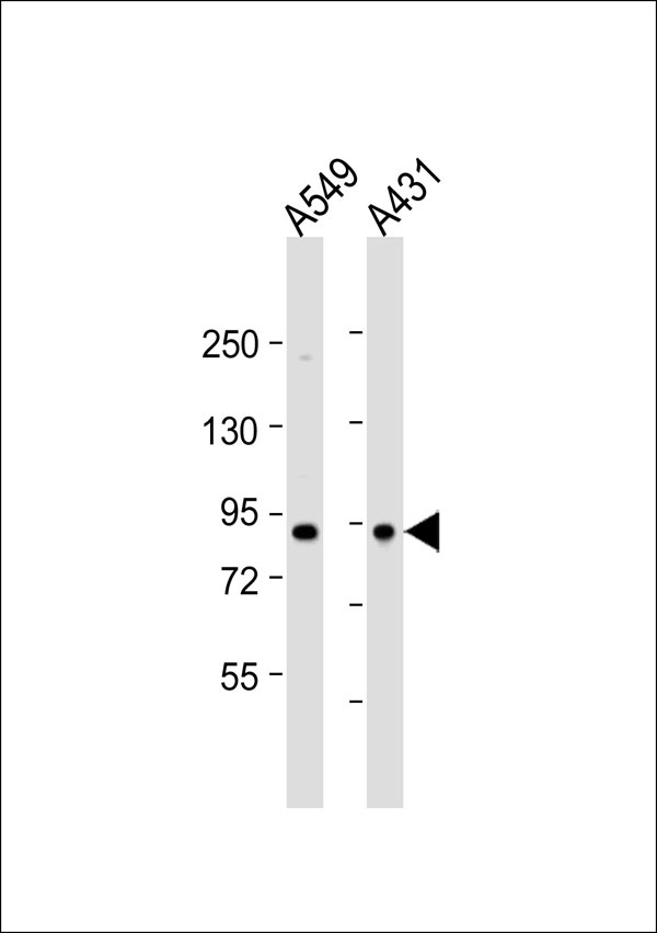 Complement C1s Antibody - All lanes: Anti-Complement C1S Antibody at 1:1000 dilution. Lane 1: A549 whole cell lysate. Lane 2: A431 whole cell lysate Lysates/proteins at 20 ug per lane. Secondary Goat Anti-Rabbit IgG, (H+L), Peroxidase conjugated at 1:10000 dilution. Predicted band size: 77 kDa. Blocking/Dilution buffer: 5% NFDM/TBST.