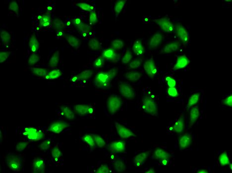 Complement C1s Antibody - Immunofluorescence analysis of HeLa cells using C1S antibody.