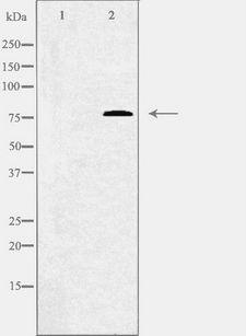 Complement C1s Antibody - Western blot analysis of extracts of Jurkat cells using C1S antibody. The lane on the left is treated with the antigen-specific peptide.