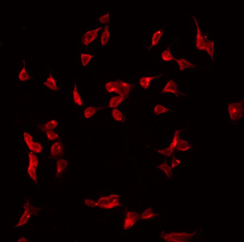 Complement C1s Antibody - Staining HeLa cells by IF/ICC. The samples were fixed with PFA and permeabilized in 0.1% Triton X-100, then blocked in 10% serum for 45 min at 25°C. The primary antibody was diluted at 1:200 and incubated with the sample for 1 hour at 37°C. An Alexa Fluor 594 conjugated goat anti-rabbit IgG (H+L) Ab, diluted at 1/600, was used as the secondary antibody.