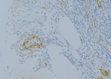 Complement C1s Antibody - 1:100 staining human uterus tissue by IHC-P. The sample was formaldehyde fixed and a heat mediated antigen retrieval step in citrate buffer was performed. The sample was then blocked and incubated with the antibody for 1.5 hours at 22°C. An HRP conjugated goat anti-rabbit antibody was used as the secondary.
