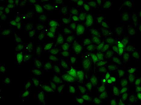 Complement C1s Antibody - Immunofluorescence analysis of A549 cells using C1S Polyclonal Antibody.
