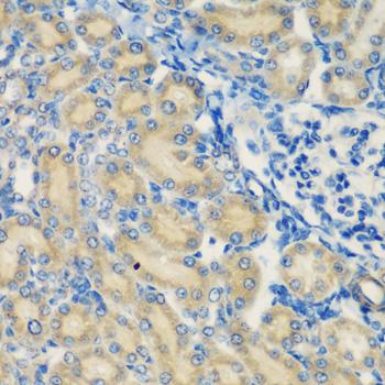 Complement C1s Antibody - Immunohistochemistry of paraffin-embedded Rat kidney using C1S Polyclonal Antibody at dilution of 1:200 (40x lens).