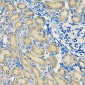 Complement C1s Antibody - Immunohistochemistry of paraffin-embedded Rat kidney using C1S Polyclonal Antibody at dilution of 1:200 (40x lens).