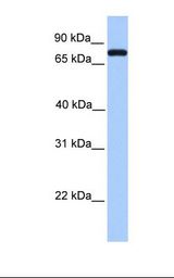 Complement C2 Antibody - Fetal heart lysate. Antibody concentration: 1.0 ug/ml. Gel concentration: 12%.  This image was taken for the unconjugated form of this product. Other forms have not been tested.