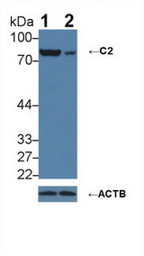 Complement C2 Antibody - Knockout Varification: Lane 1: Wild-type A431 cell lysate; Lane 2: C2 knockout A431 cell lysate; Predicted MW: 60,69,83kDa Observed MW: 83kDa Primary Ab: 1µg/ml Rabbit Anti-Human C2 Antibody Second Ab: 0.2µg/mL HRP-Linked Caprine Anti-Rabbit IgG Polyclonal Antibody
