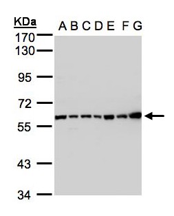 Complement C2 Antibody - Sample (30 ug whole cell lysate). A:293T, B: A431 , C: H1299, D: HeLa S3 , E: Hep G2 . F: MOLT4 . G: Raji . 7.5% SDS PAGE. Complement C2 antibody diluted at 1:1000