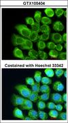 Complement C2 Antibody - Immunofluorescence of methanol-fixed A431 using Complement C2 antibody at 1:200 dilution.