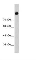 Complement C2 Antibody - HepG2 Cell Lysate.  This image was taken for the unconjugated form of this product. Other forms have not been tested.