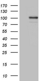 Complement C2 Antibody - HEK293T cells were transfected with the pCMV6-ENTRY control. (Left lane) or pCMV6-ENTRY C2. (Right lane) cDNA for 48 hrs and lysed. Equivalent amounts of cell lysates. (5 ug per lane) were separated by SDS-PAGE and immunoblotted with anti-C2. (1:2000)