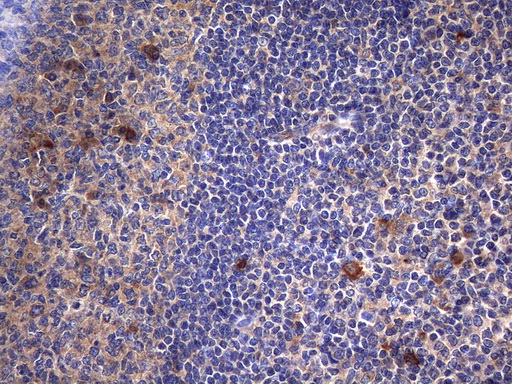 Complement C2 Antibody - Immunohistochemical staining of paraffin-embedded Human tonsil within the normal limits using anti-C2 mouse monoclonal antibody. (Heat-induced epitope retrieval by 1mM EDTA in 10mM Tris buffer. (pH8.5) at 120°C for 3 min. (1:150)