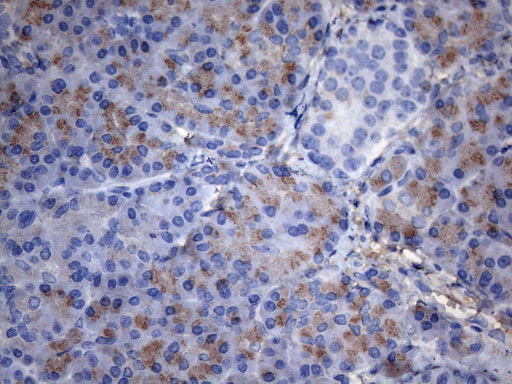 Complement C2 Antibody - Immunohistochemical staining of paraffin-embedded Human pancreas tissue within the normal limits using anti-C2 mouse monoclonal antibody. (Heat-induced epitope retrieval by 1mM EDTA in 10mM Tris buffer. (pH8.5) at 120°C for 3 min. (1:150)