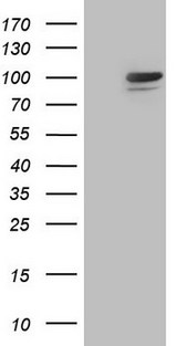 Complement C2 Antibody - HEK293T cells were transfected with the pCMV6-ENTRY control. (Left lane) or pCMV6-ENTRY C2. (Right lane) cDNA for 48 hrs and lysed. Equivalent amounts of cell lysates. (5 ug per lane) were separated by SDS-PAGE and immunoblotted with anti-C2. (1:500)