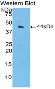 Complement C3 Antibody - Western blot of recombinant Complement C3.
