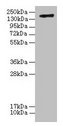 Complement C3 Antibody - Western blot All lanes: Complement C3 antibody at 20µg/ml + Human high value serumGoat polyclonal to rabbit IgG at 1/10000 dilution Secondary Goat polyclonal to rabbit IgG at 1/10000 dilution Predicted band size: 187, 61 kDa Observed band size: 187 kDa