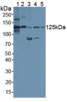 Complement C3c Antibody - Western Blot; Sample: Lane1: Mouse Serum; Lane2: Human Serum; Lane3: Mouse Lung Tissue; Lane4: Mouse Heart Tissue; Lane5: Human HepG2 Cells.
