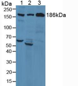 Complement C3c Antibody - Western Blot; Sample: Lane1: Human Liver Tissue; Lane2: Human Lung Tissue; Lane3: Human Serum.