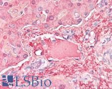 Complement C3d Antibody - Human Liver, Vessel: Formalin-Fixed, Paraffin-Embedded (FFPE)