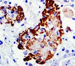 Complement C3d Antibody - IHC of C3d on FFPE Rejected Kidney Transplant tissue. This image was taken for the unmodified form of this product. Other forms have not been tested.