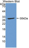 Complement C4 Antibody - Western blot of recombinant C4 / Complement C4a.