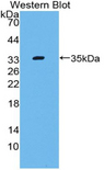 Complement C4 Antibody - Western blot of recombinant C4 / Complement C4a.