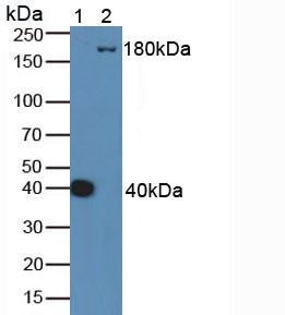 Complement C4 Antibody - Western Blot; Sample: Lane1: Mouse Serum; Lane2: Human HepG2 Cells.