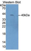 Complement C4 Antibody - Western blot of Complement C4a antibody.