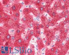 Complement C4 Antibody - Human Liver: Formalin-Fixed, Paraffin-Embedded (FFPE)