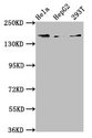 Complement C4a Antibody - Positive Western Blot detected in Hela whole cell lysate, HepG2 whole cell lysate, 293T whole cell lysate. All lanes: C4A antibody at 3.9 µg/ml Secondary Goat polyclonal to rabbit IgG at 1/50000 dilution. Predicted band size: 193, 188 KDa. Observed band size: 193 KDa
