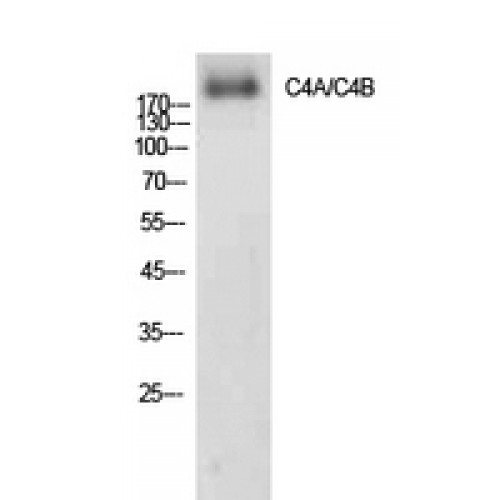 Complement C4a+b Antibody - Western blot of C4a/b antibody