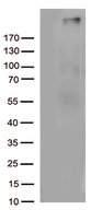 Complement C4b Antibody - HEK293T cells were transfected with the pCMV6-ENTRY control. (Left lane) or pCMV6-ENTRY C4B. (Right lane) cDNA for 48 hrs and lysed. Equivalent amounts of cell lysates. (5 ug per lane) were separated by SDS-PAGE and immunoblotted with anti-C4B. (1:500)