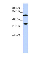 Complement C4b Antibody - C4B antibody Western blot of HeLa lysate. This image was taken for the unconjugated form of this product. Other forms have not been tested.