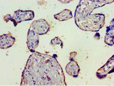 Complement C4b Antibody - Immunohistochemistry of paraffin-embedded human placenta tissue using antibody at 1:100 dilution.  This image was taken for the unconjugated form of this product. Other forms have not been tested.