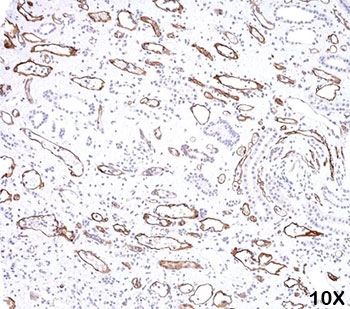 Complement C4d Antibody - C4d antibody Complement 4d immunohistochemistry 1.  This image was taken for the unmodified form of this product. Other forms have not been tested.